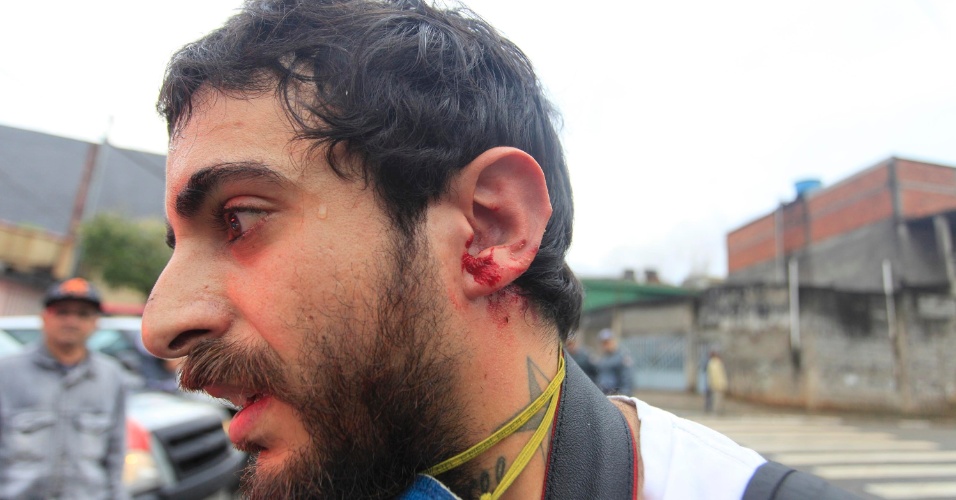 Nelson Antoine, da Associated Press, foi atingido com estilhaços de uma bomba de efeito moral (Crédito: Gabriela Biló/Futura Press)