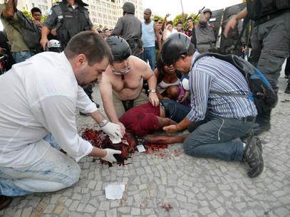 Cinegrafista da Band foi atingido por uma bomba durante a cobertura do protesto na Central do Brasil (Crédito: Daniel Ramalho / Terra)