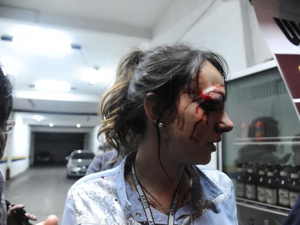 Giuliana Vallone, da Folha de S. Paulo, foi atingida no olho por uma bala de borracha. Na foto, é possível ver que ela estava com o crachá da Folha. (Crédito: Guilherme Kastner / Brazil Photo Press).